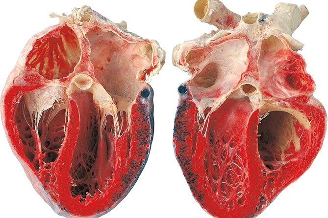 Ticket Expo Body Worlds in Bruges, Belgium - Planning one to two hours at Site Oud Sint-Jan